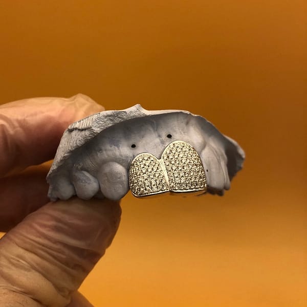 Etched Gold Cap